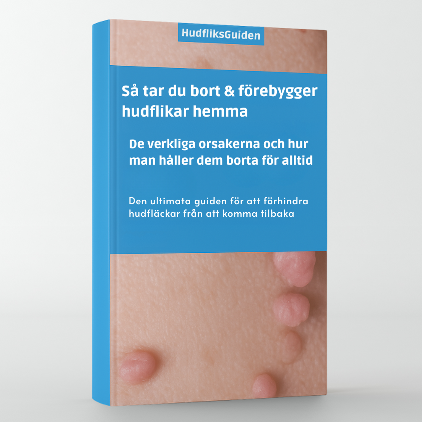 Hudfliksguiden Ebok - Så tar du bort & förebygger hudflikar hemma