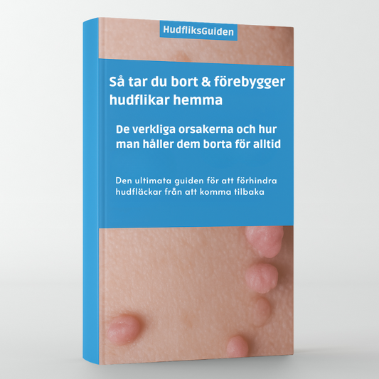 Hudfliksguiden Ebok - Så tar du bort & förebygger hudflikar hemma