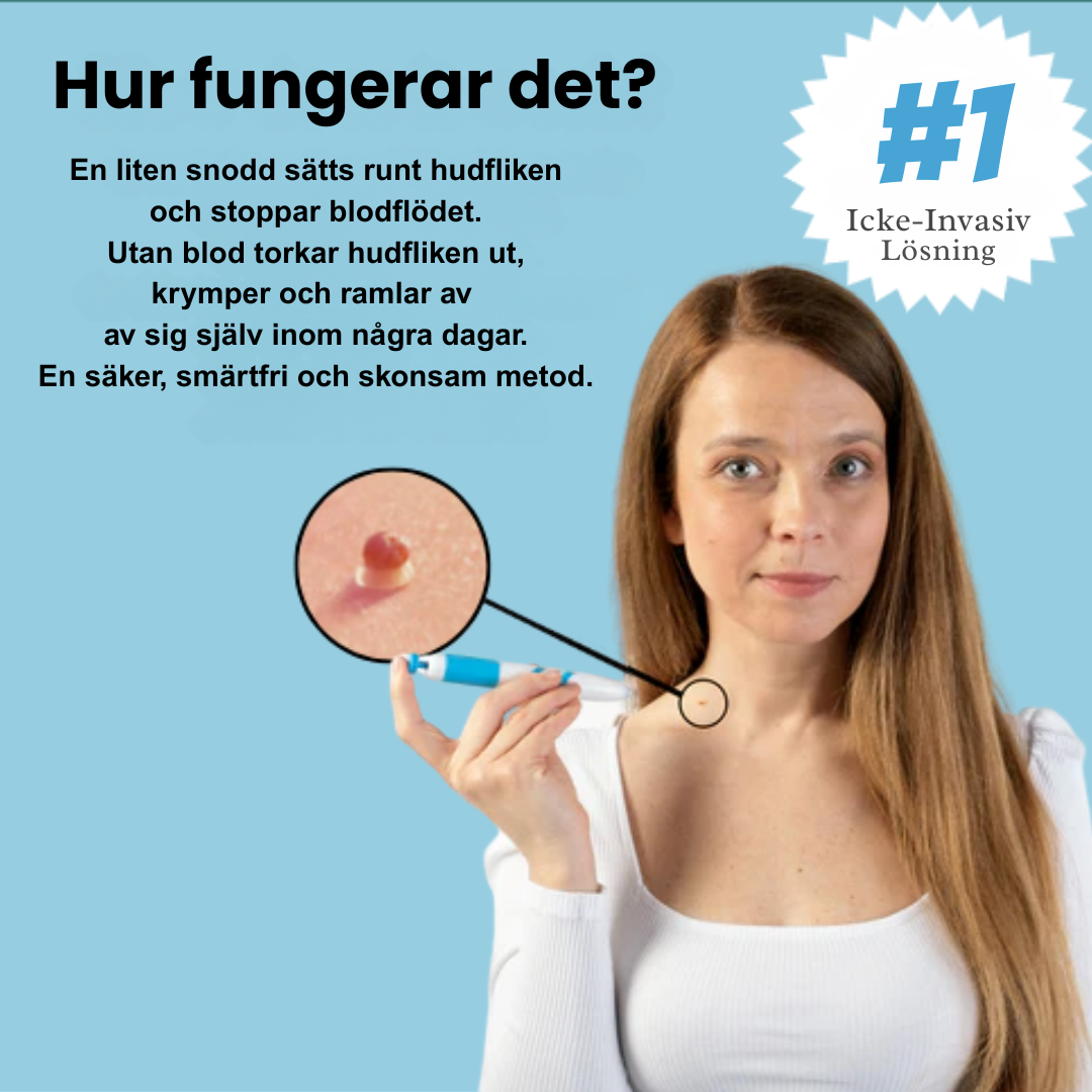 TagAway - Fri från hudflikar på nolltid